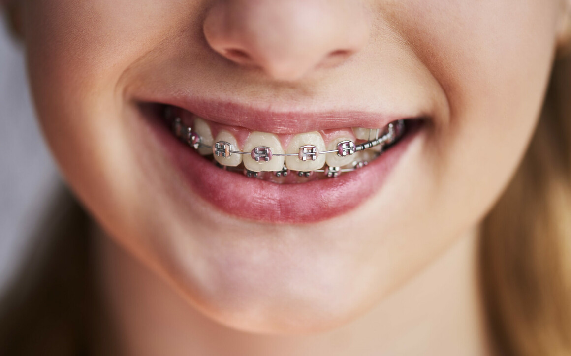 Smil